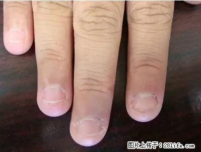 剪指甲、挖耳屎，这些日常小动作竟隐藏大危害！ - 阳江生活资讯 - 阳江28生活网 yj.28life.net